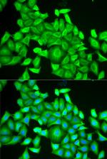 RAB6A Antibody in Immunocytochemistry (ICC/IF)