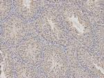 CDA Antibody in Immunohistochemistry (Paraffin) (IHC (P))