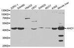 AHCY Antibody in Western Blot (WB)