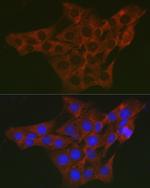 WNK3 Antibody in Immunocytochemistry (ICC/IF)