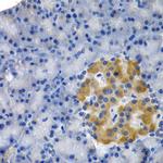 HSPB8 Antibody in Immunohistochemistry (Paraffin) (IHC (P))