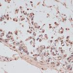 PRPF31 Antibody in Immunohistochemistry (Paraffin) (IHC (P))