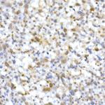 SMARCB1 Antibody in Immunohistochemistry (Paraffin) (IHC (P))