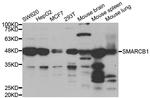 SMARCB1 Antibody in Western Blot (WB)