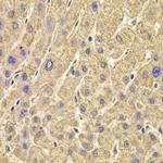 PEX5 Antibody in Immunohistochemistry (Paraffin) (IHC (P))