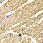 PEX5 Antibody in Immunohistochemistry (Paraffin) (IHC (P))