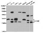 COMT Antibody in Western Blot (WB)