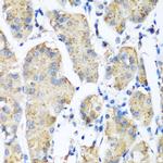 Pleckstrin Antibody in Immunohistochemistry (Paraffin) (IHC (P))