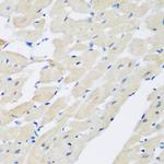 Pleckstrin Antibody in Immunohistochemistry (Paraffin) (IHC (P))