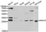 ARD1A Antibody in Western Blot (WB)