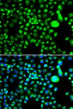 SMCHD1 Antibody in Immunocytochemistry (ICC/IF)