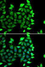 IKZF3 Antibody in Immunocytochemistry (ICC/IF)