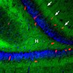 beta-3 Adrenergic Receptor (extracellular) Antibody in Immunohistochemistry (IHC)