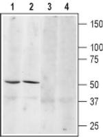 beta-3 Adrenergic Receptor (extracellular) Antibody in Western Blot (WB)