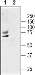 KV1.1 (KCNA1) (extracellular) Antibody in Western Blot (WB)