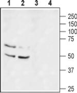 KV1.1 (KCNA1) (extracellular) Antibody in Western Blot (WB)