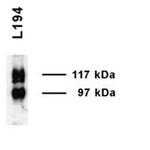 UT-A1 Antibody in Western Blot (WB)