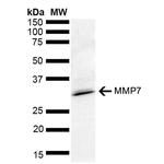 MMP7 Antibody in Western Blot (WB)