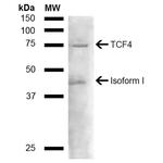 TCF4 Antibody in Western Blot (WB)