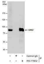 GRK2 Antibody in Immunoprecipitation (IP)