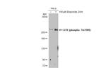 Phospho-ATR (Thr1989) Antibody in Western Blot (WB)