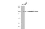 Phospho-ATR (Thr1989) Antibody in Western Blot (WB)