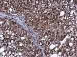 Phospho-ATR (Thr1989) Antibody in Immunohistochemistry (Paraffin) (IHC (P))