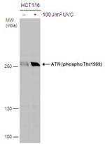 Phospho-ATR (Thr1989) Antibody in Western Blot (WB)