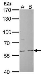 Cdc6 Antibody in Western Blot (WB)