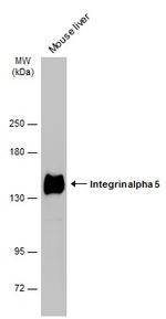 ITGA5 Antibody in Western Blot (WB)