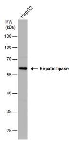 LIPC Antibody in Western Blot (WB)