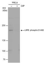 Phospho-LRP6 (Ser1490) Antibody in Western Blot (WB)