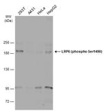 Phospho-LRP6 (Ser1490) Antibody in Western Blot (WB)