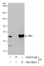 ME2 Antibody in Immunoprecipitation (IP)