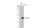 RAB7A Antibody in Western Blot (WB)