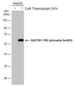 Phospho-SQSTM1 (Ser403) Antibody in Western Blot (WB)