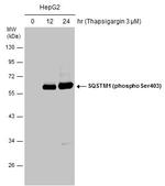 Phospho-SQSTM1 (Ser403) Antibody in Western Blot (WB)