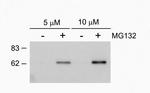 Phospho-SQSTM1 (Ser403) Antibody in Western Blot (WB)