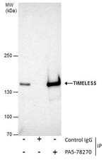 TIMELESS Antibody in Immunoprecipitation (IP)