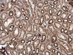 ROCK2 Antibody in Immunohistochemistry (Paraffin) (IHC (P))