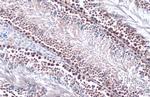 PRMT5 Antibody in Immunohistochemistry (Paraffin) (IHC (P))