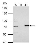 PRMT5 Antibody in Immunoprecipitation (IP)