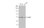 PRMT5 Antibody in Western Blot (WB)