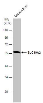 SLC19A2 Antibody in Western Blot (WB)