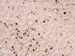 NUDT21 Antibody in Immunohistochemistry (Paraffin) (IHC (P))