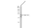 DJ-1 Antibody in Western Blot (WB)