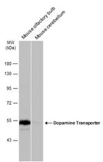 Dopamine Transporter Antibody in Western Blot (WB)