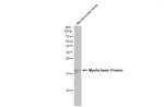 MBP Antibody in Western Blot (WB)