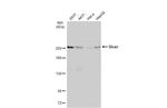 Dicer Antibody in Western Blot (WB)