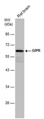 GIPR Antibody in Western Blot (WB)